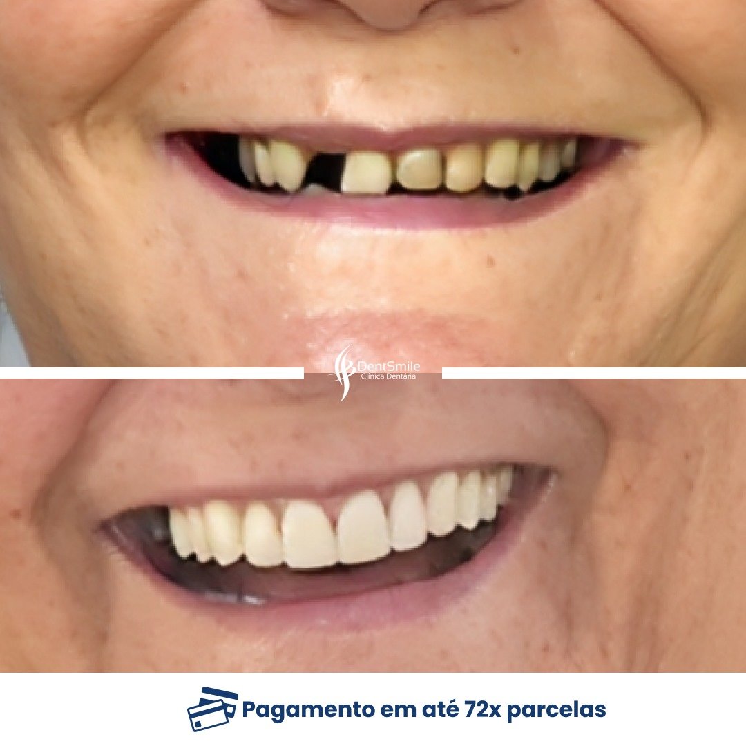 WhatsApp Image 2025-03-12 at 11.09.19 (4)