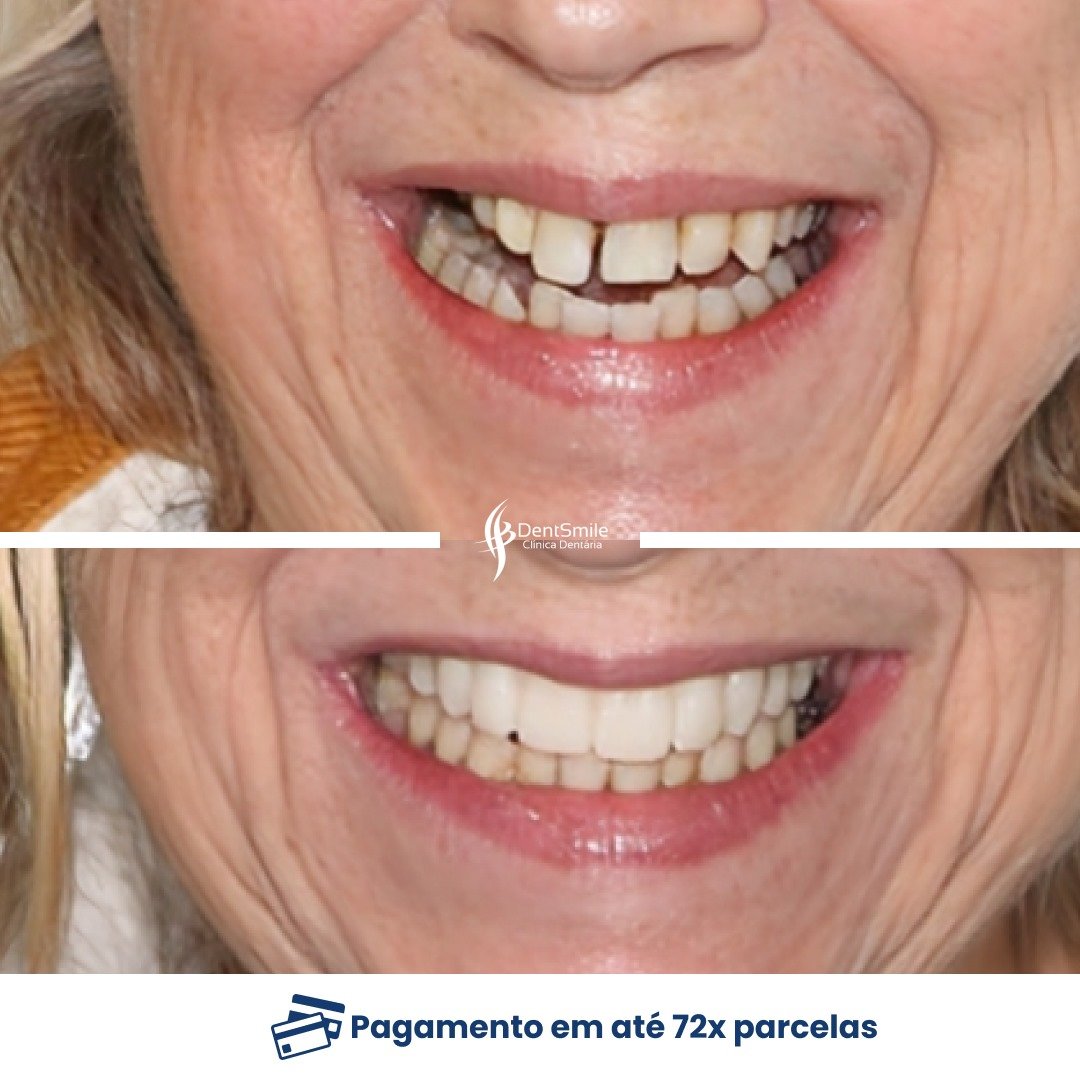 WhatsApp Image 2025-03-12 at 11.09.20 (3)